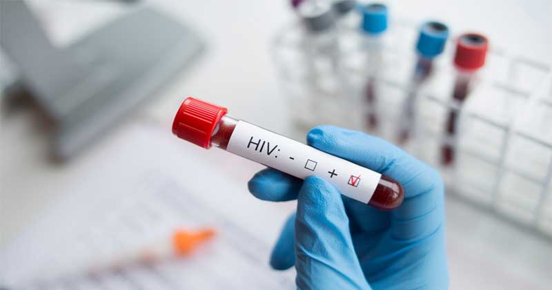HIV Nasıl Bulaşır?